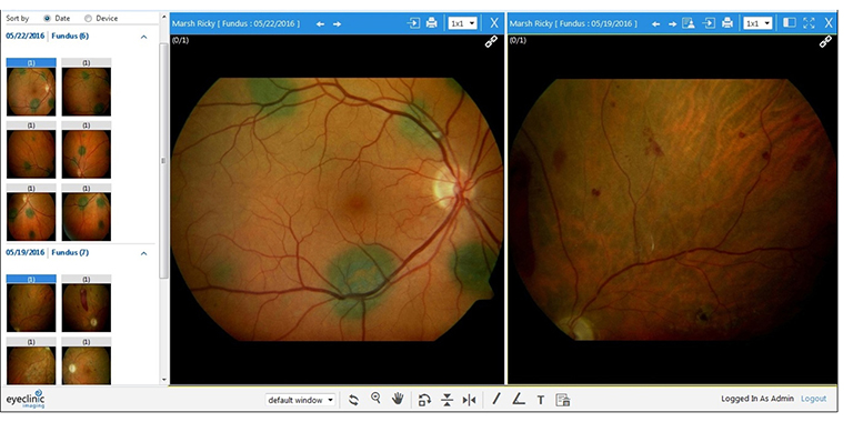 EyeClinic Imaging