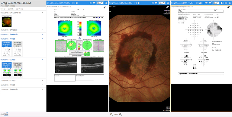 EyeClinic Imaging OCT, Fundus and Visual Field