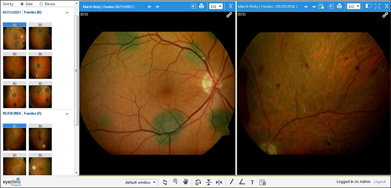 EyeClinic Imaging Compare Prior Exam