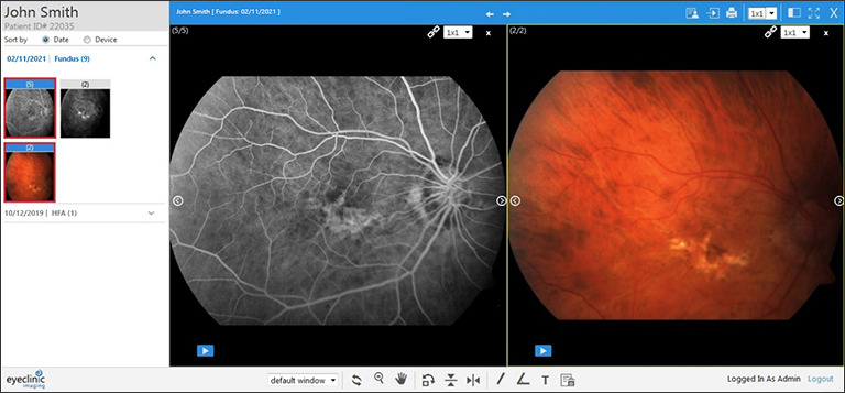 EyeClinic Imaging View Multiple Images