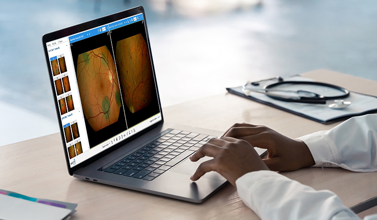 Ophthalmic Image Management System